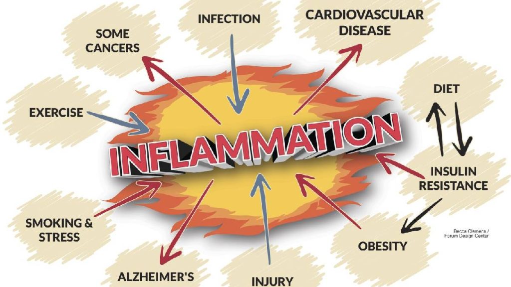 inflammation