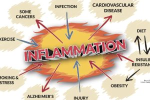 inflammation