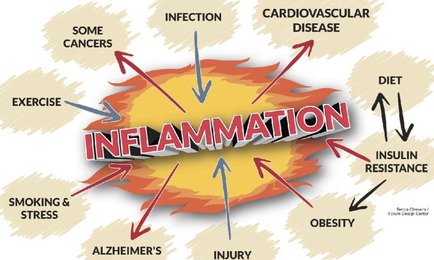 inflammation